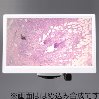 『【顕微鏡用Cマウントカメラ】HD1500MM』商品画像